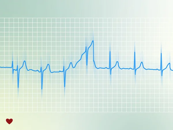 Elettrocardiogramma — Foto Stock