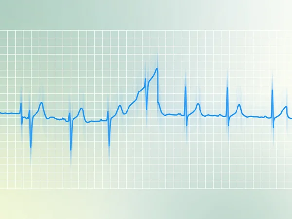 Elettrocardiogramma — Foto Stock