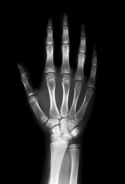 Человеческая рука — стоковое фото