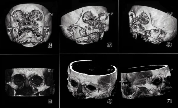Магнітно-резонансну томографію — стокове фото