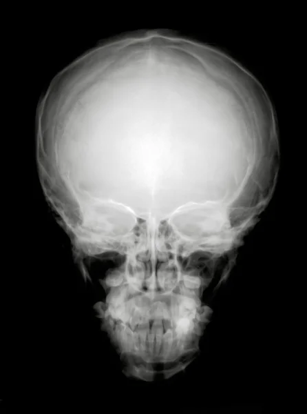 Head from front — Stock Photo, Image