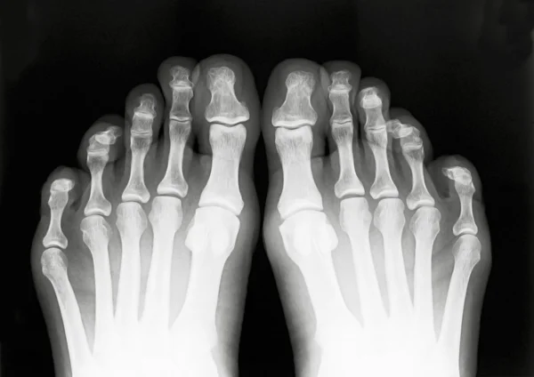 Пальцы ног — стоковое фото