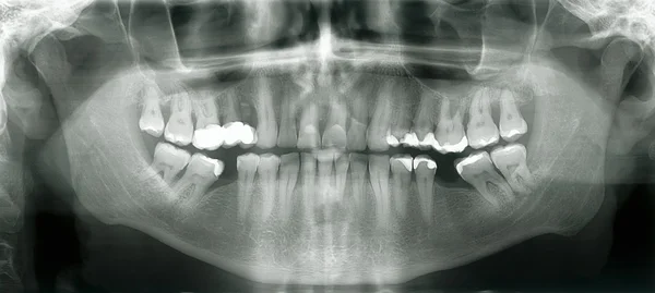 Στόμα xray — Φωτογραφία Αρχείου