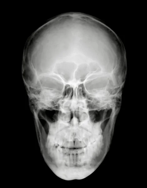 Vista frontal da cabeça — Fotografia de Stock