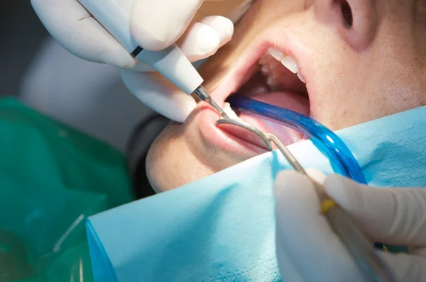 치과 의사가 그의 환자에 대 한 검색을 수행 — 스톡 사진