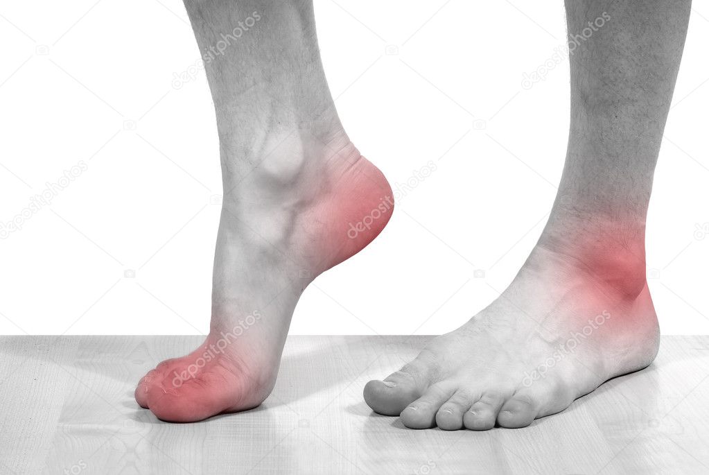 Disease of the feet