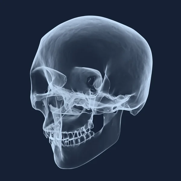 Teschio della testa umana a raggi X — Foto Stock