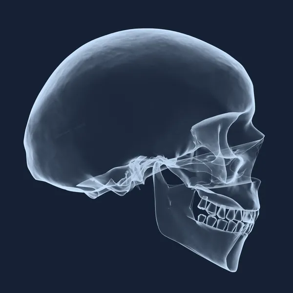 Crâne humain de tête de rayon X — Photo