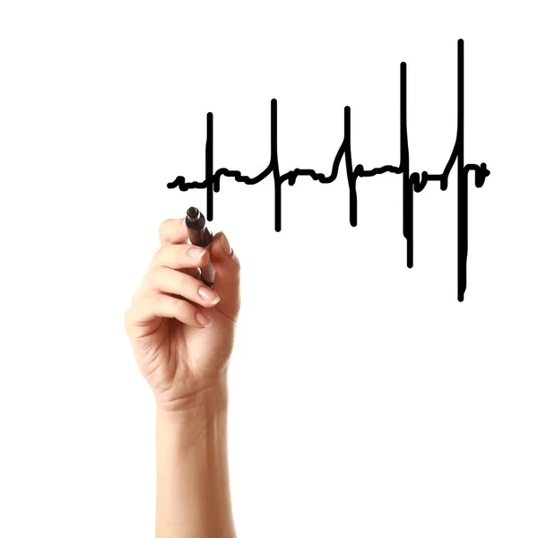 Cardiogram — Stock Photo, Image