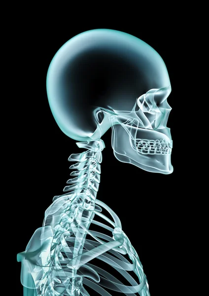 Hombre de rayos X —  Fotos de Stock