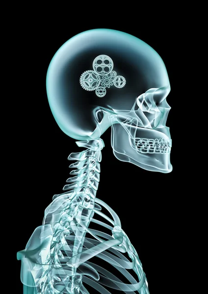 X-ray KPV — Stockfoto