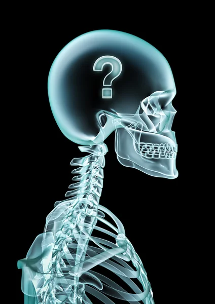 X-ray otázka — Stock fotografie