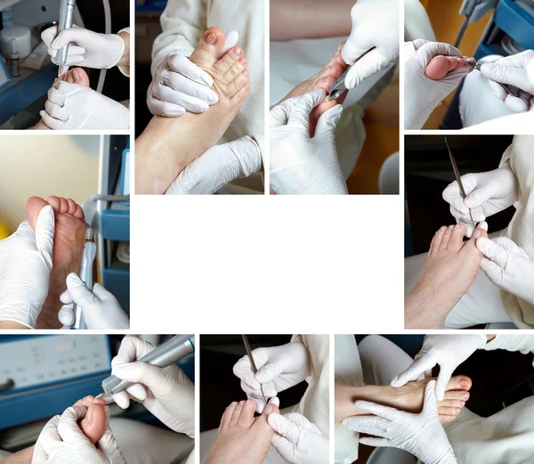 Догляд за ногами в процесі фотоколаж — стокове фото