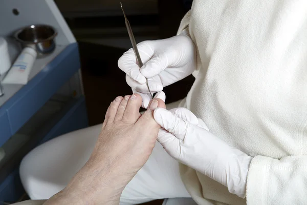 Foot Care in process — Stock Photo, Image
