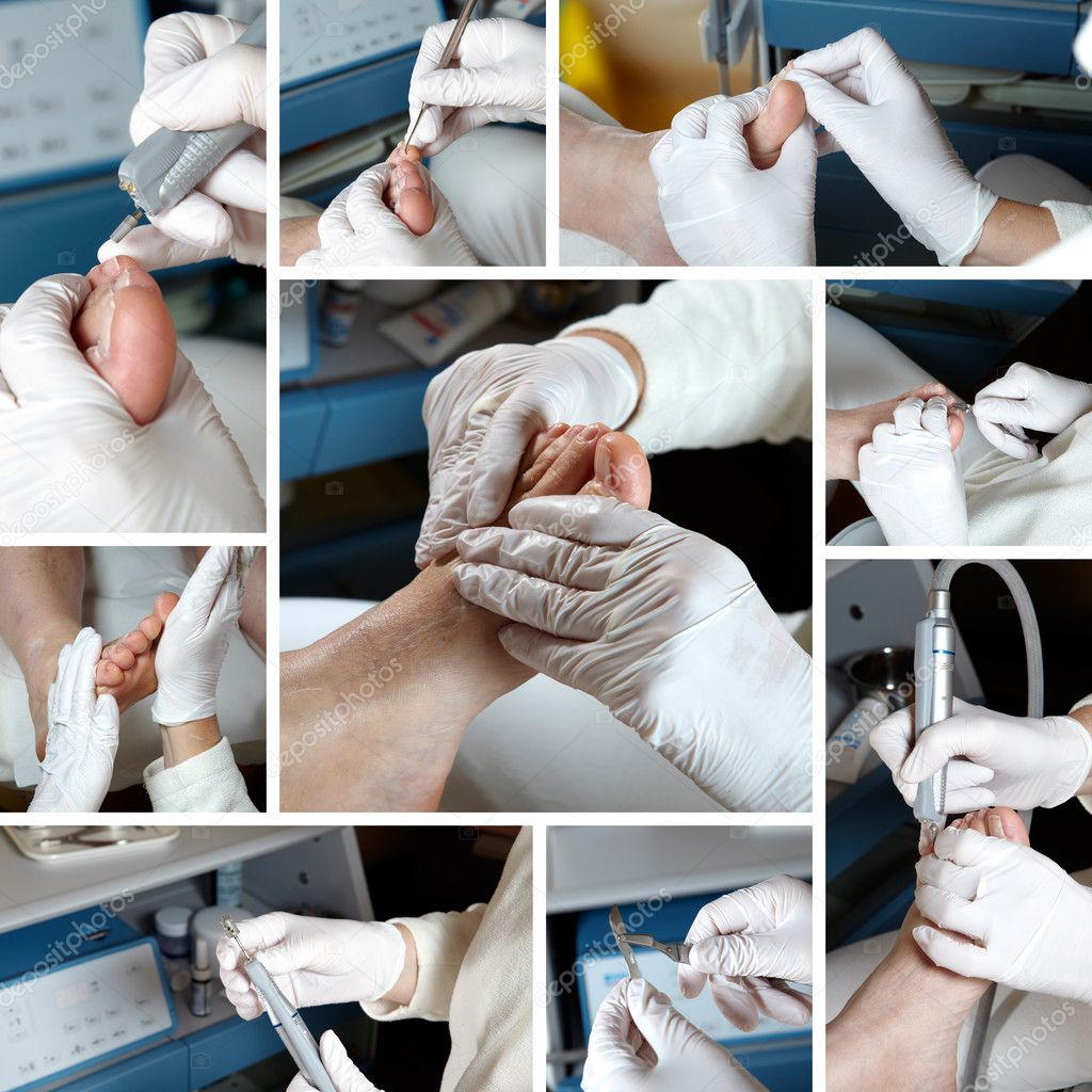 Foot Care in process - Photo Collage