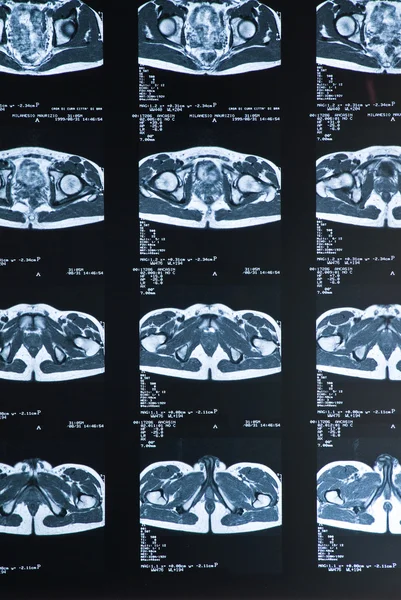 Radiografia magnética ressonante — Fotografia de Stock