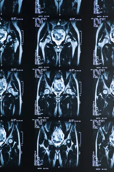 Radiografia magnética ressonante — Fotografia de Stock