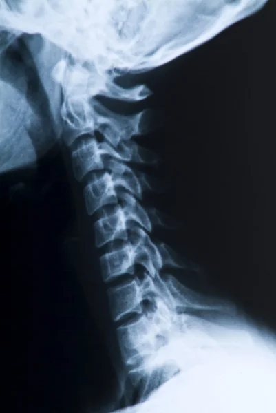 Radiografie van het hoofd en de nek — Stockfoto