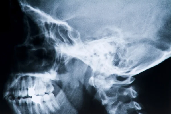 Radiographie de la tête et des dents — Photo