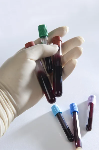 Tubi e campioni di sangue — Foto Stock