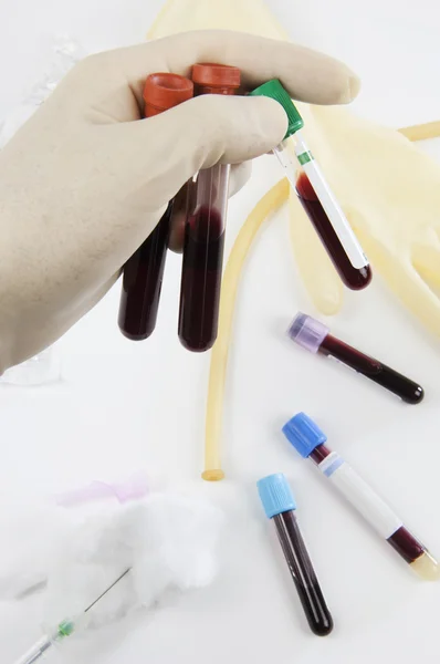 Tubes, and blood samples — Stock Photo, Image