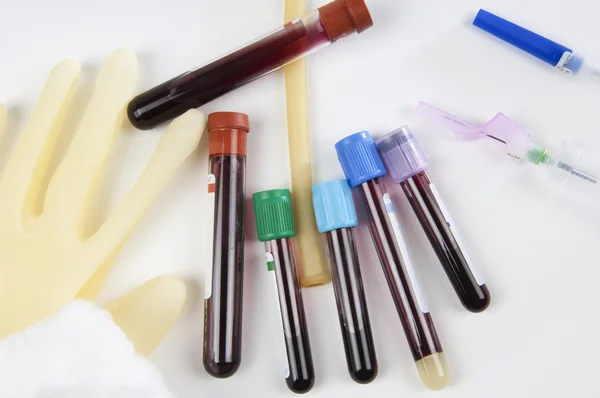 Tubos de ensaio com amostras de sangue — Fotografia de Stock