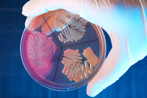 Патологічний бактерії — стокове фото