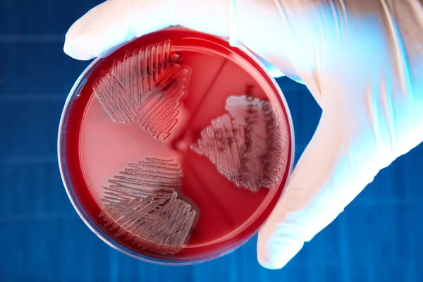 Patologiska bakterier — Stockfoto