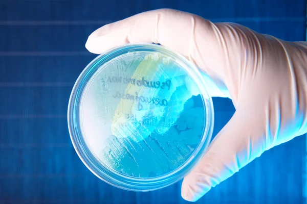 Bakterie patologiczne — Zdjęcie stockowe