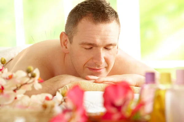 Homem recebendo tratamento de acupuntura em um spa — Fotografia de Stock