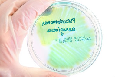 Pathological bacteria clipart