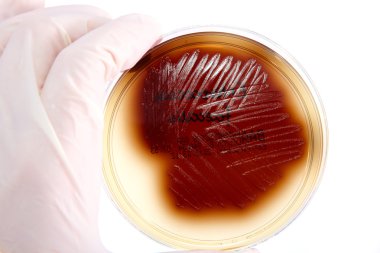 Pathological bacteria clipart
