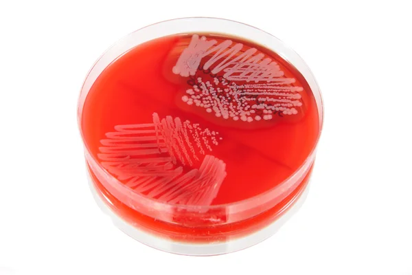 Bactérias patológicas — Fotografia de Stock