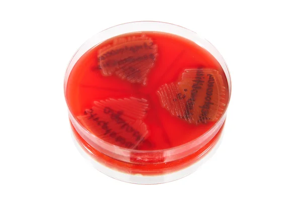 Παθολογικών βακτηριδίων — Φωτογραφία Αρχείου