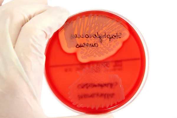 Патологические бактерии — стоковое фото