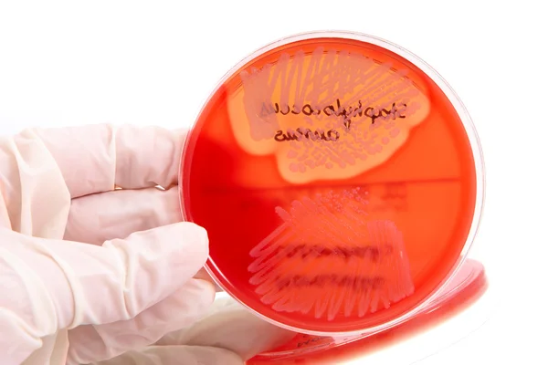Bacterias patológicas — Foto de Stock