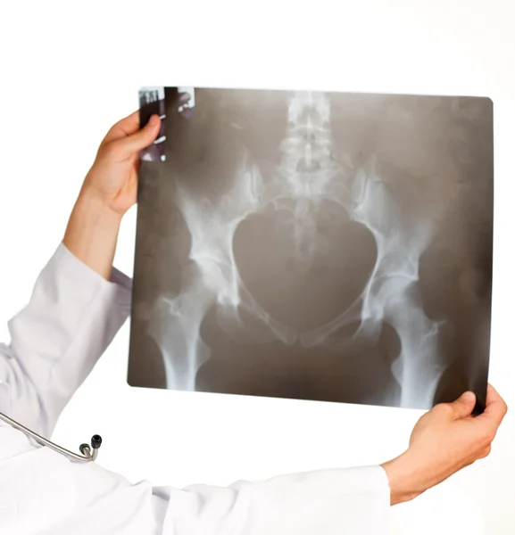 Auflösung einer Röntgenaufnahme — Stockfoto