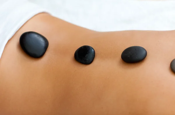Tratamiento de spa con piedras — Foto de Stock