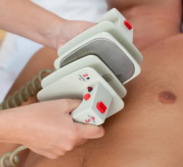 Nahaufnahme eines Arztes bei der Vorbereitung eines Defibrillators — Stockfoto