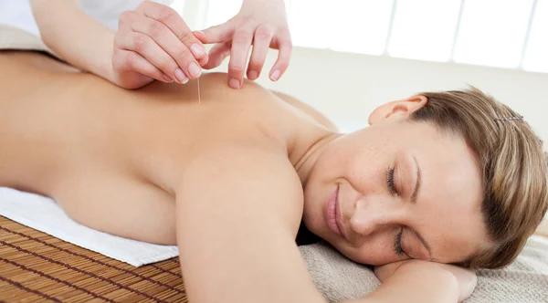 Akupunktur nålar på en vacker kvinnas rygg — Stockfoto