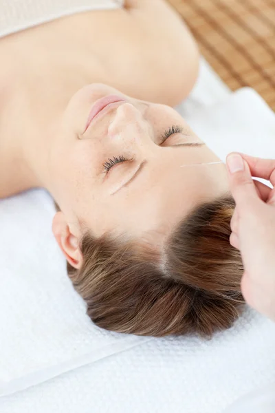 Cauasian kadının kafasına akupunktur iğneleri — Stok fotoğraf