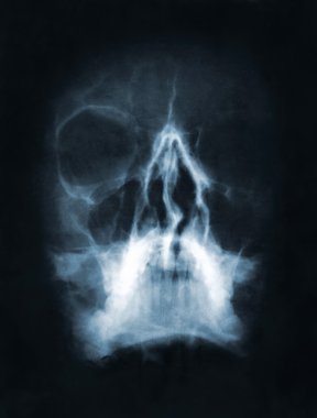 Skull x-ray image clipart