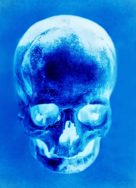 Blaues Röntgenbild des Schädels — Stockfoto