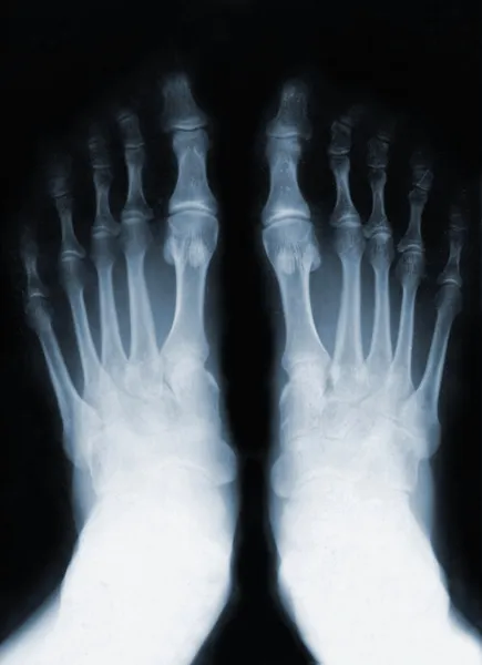 Foot fingers — Φωτογραφία Αρχείου