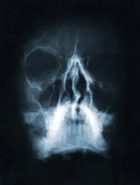 Череп рентгенівських знімки — стокове фото