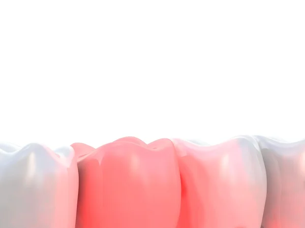 Dor de dente 3d — Fotografia de Stock
