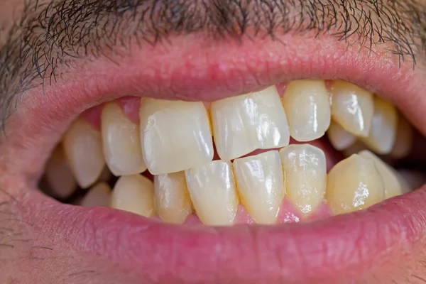 Homme caucasien dents — Photo
