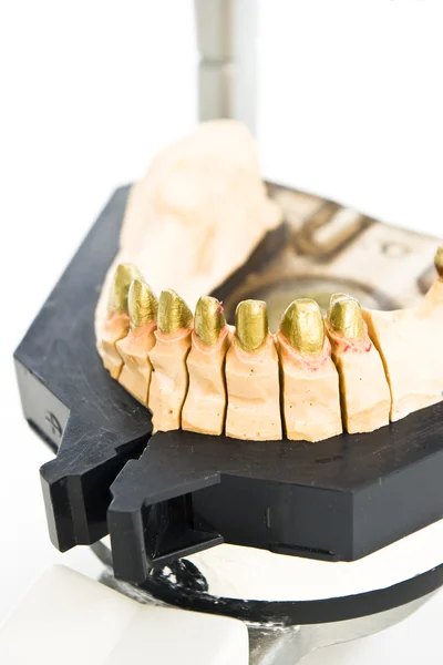 Metal molde dental — Fotografia de Stock