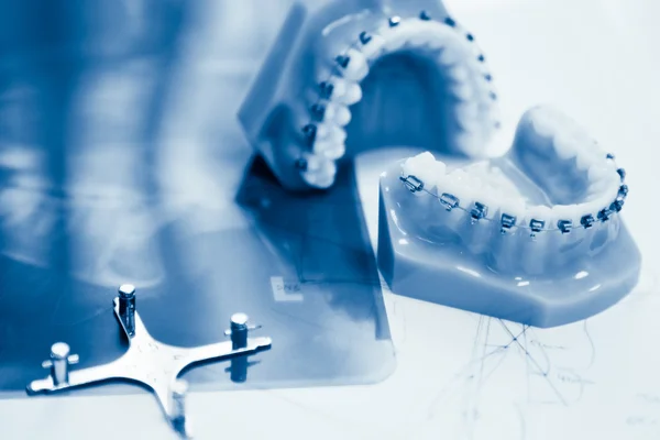 Ортодонтичні інструменти — стокове фото