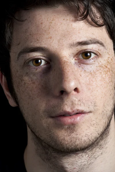 Man with Freckles — Stock Photo, Image
